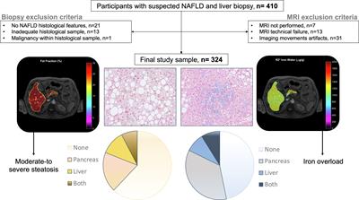 Pancreatic steatosis and iron overload increases cardiovascular risk in non-alcoholic fatty liver disease